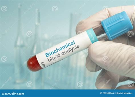 biochemical analysis report|biochemical analysis of blood.